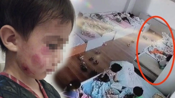 4 yaşındaki kız çocuğu, yatakta uyuyan çocuğu 13 yerinden ısırdı