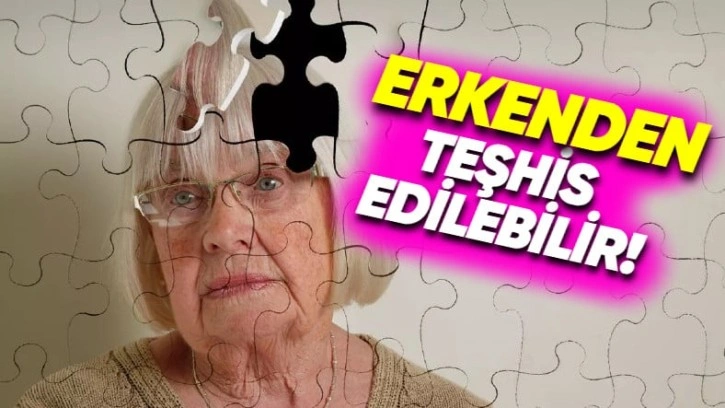 Alzheimer’ın Semptomlardan Bile Önce Tespit Edilmesini Sağlayacak Yöntem