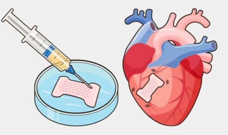 Araştırma: İnsan kök hücrelerinden üretilen bantlar kalp deliklerini kalıcı olarak kapatabilir