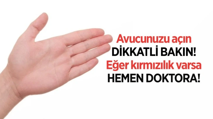 Avucunuzu açın ne dikkatli bakın! Kızarıklık varsa hiç durmayın hemen doktora gidin!