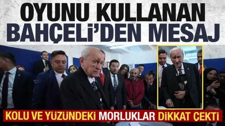 Bahçeli oyunu kullandı! Yüzündeki morlukların nedeni belli oldu