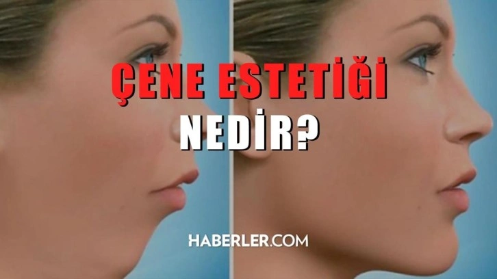 Çene estetiği nedir? Çene estetiği nasıl yapılır?