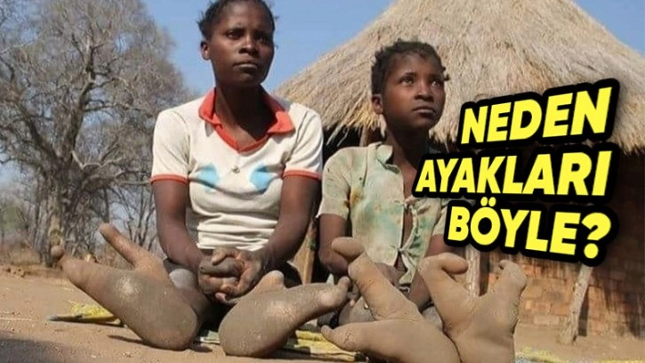 Devekuşu Ayaklı Afrika Kabilesi