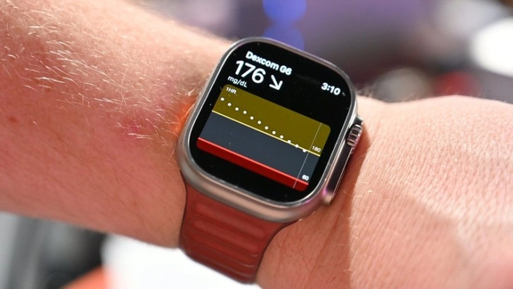 Dexcom G7 Apple Watch'a Bağlanabilecek