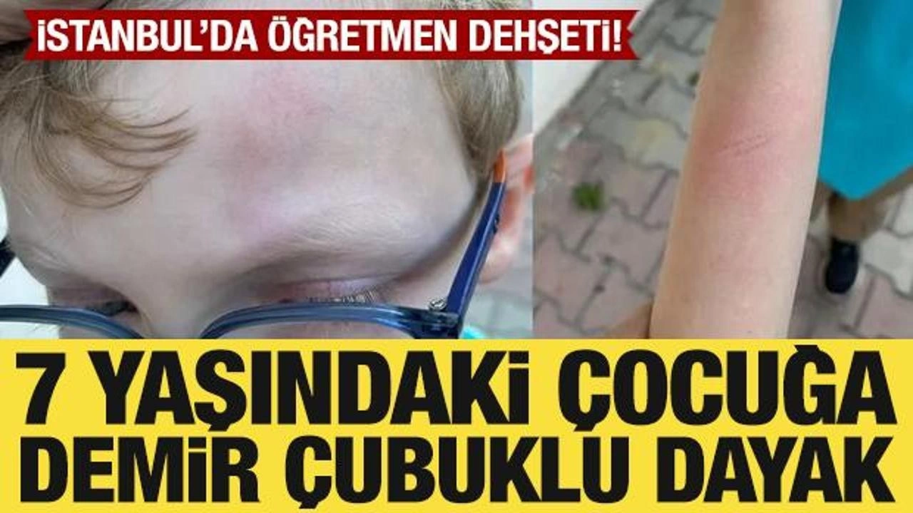 İstanbul'da öğretmenden 7 yaşındaki çocuğa demir çubuklu dayak