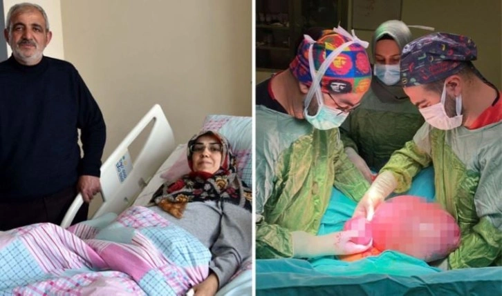 Karnını kaplayan kitle operasyonla çıkartıldı, doktorlar bile şaşırdı: 'Çok nadir görüyoruz