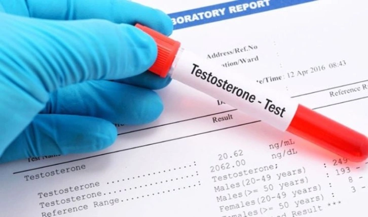 Otuzlu yaşlardan itibaren testosteron seviyesi azalıyor