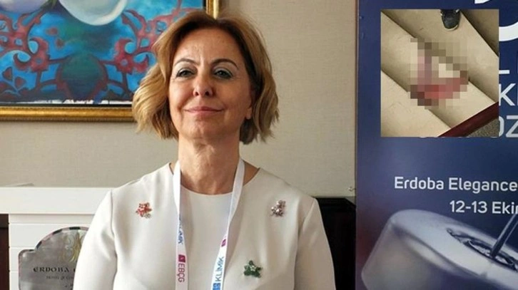 Profesör Şenol'u "dana dili" ile tehdit eden sanık hakkında yakalama kararı