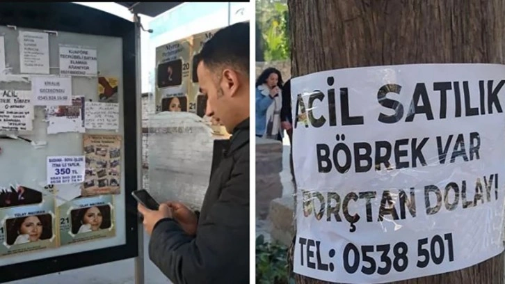 'Satılık böbrek' var! Bağışçıdan çok böbrek satmak isteyen var geçinmek için...