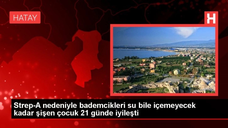 Strep-A nedeniyle bademcikleri su bile içemeyecek kadar şişen çocuk 21 günde iyileşti