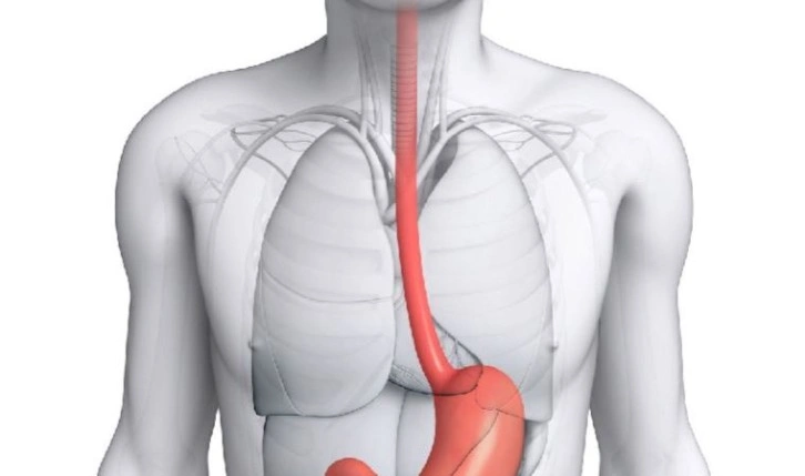 Yemek borusu kanseri neden olur? Yemek borusu kanserinin belirtileri nelerdir?