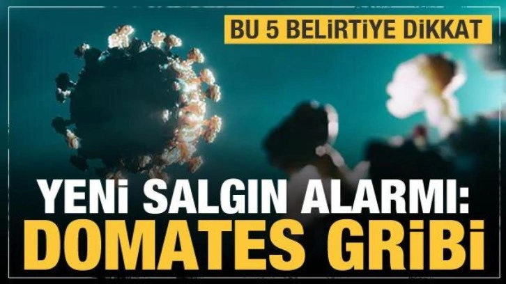 Yeni salgın alarmı: Domates gribi! Bu 5 belirtiye dikkat