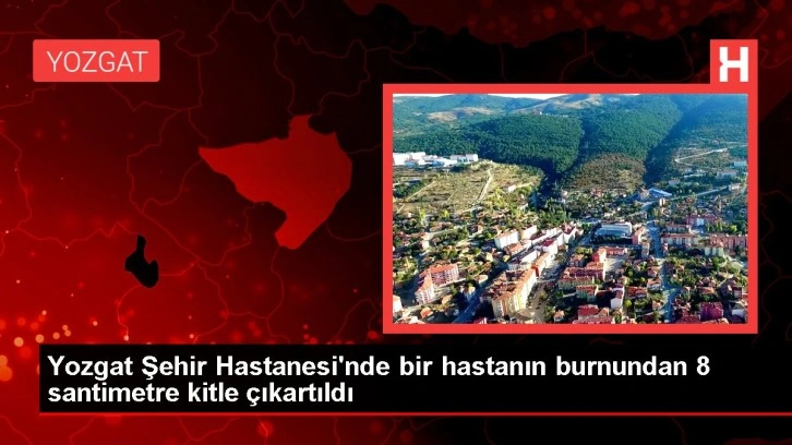 Yozgat Şehir Hastanesi'nde bir hastanın burnundan 8 santimetre kitle çıkartıldı