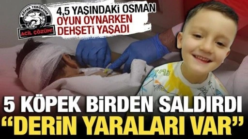 Adıyaman'da dehşet: 4,5 yaşındaki çocuğa 5 köpek birden saldırdı!