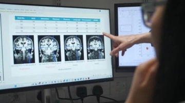 Alzheimer'a karşı mücadelede oyunun kurallarını değiştirecek!