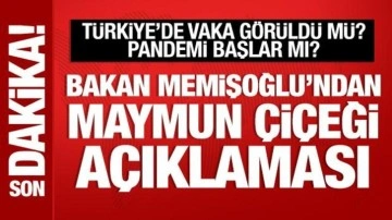 Bakan Memişoğlu'ndan maymun çiçeği açıklaması: Pandemi olmaz