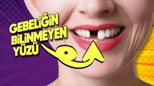 Bazı Kadınların Hamilelikte Neden Dişleri Dökülüyor?