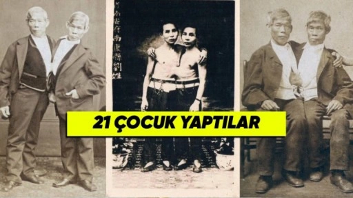 Birbirine Yapışık 21 Çocuk Yapan Siyam İkizlerinin Hikâyesi