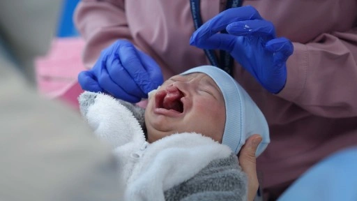 Dudak damağı yarığıyla dünyaya gelen Muhamed Medipol'de sağlık yolculuğuna başladı