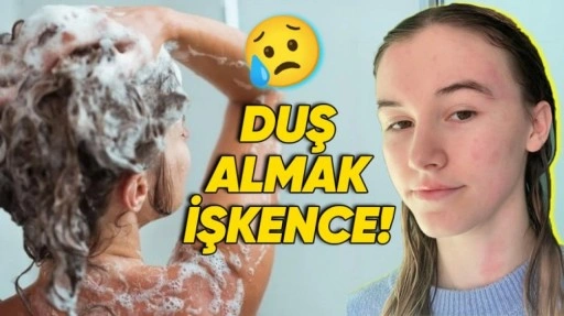 Duş, Yağmur Yasak! Su Alerjisiyle Yaşamak Nasıl Bir Şey?