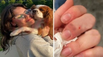 Yer: İzmit! AVM'de dehşet saçan başıboş köpek, 14 yaşındaki kıza ve köpeğine saldırdı