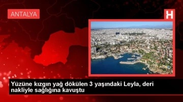 Yüzüne kızgın yağ dökülen 3 yaşındaki Leyla, deri nakliyle sağlığına kavuştu